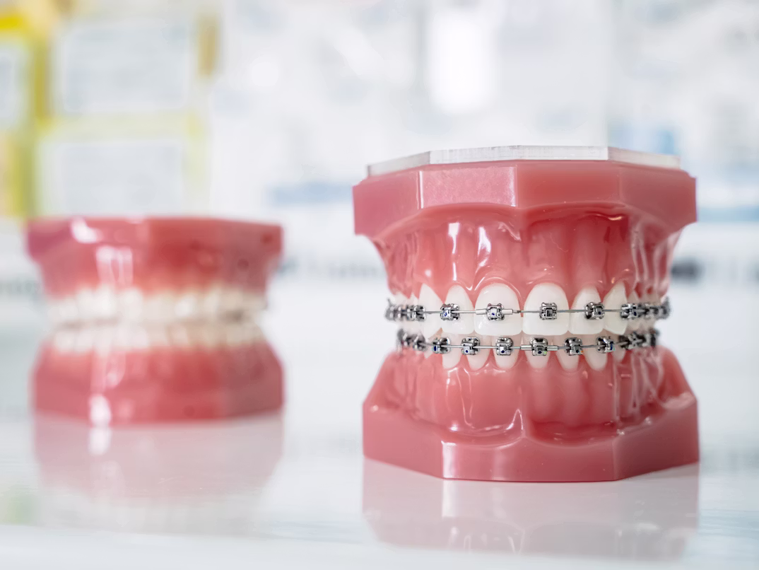 Orthodontic treatment